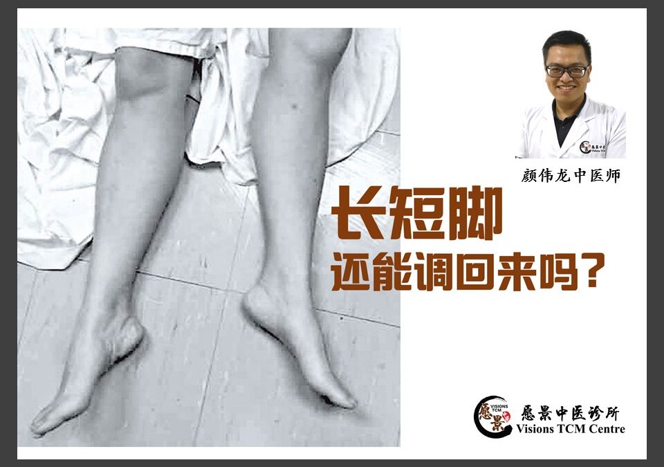 我有长短脚？还能调回来吗？【颜伟龙医师】