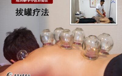 【用30秒学中医知识】- 拔罐疗法