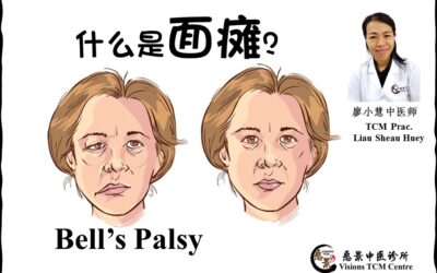 面瘫（学名：面神经麻痹）【廖小慧医师】