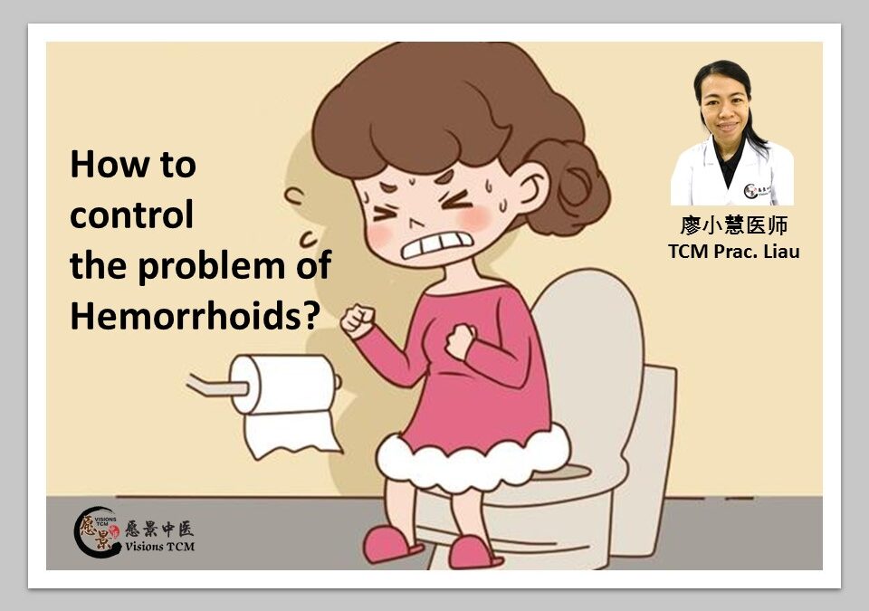 How to control the problem of Hemorrhoids? 【TCM Liau】