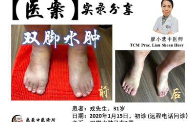 【医案实录】双脚水肿已两周 – 廖小慧医师