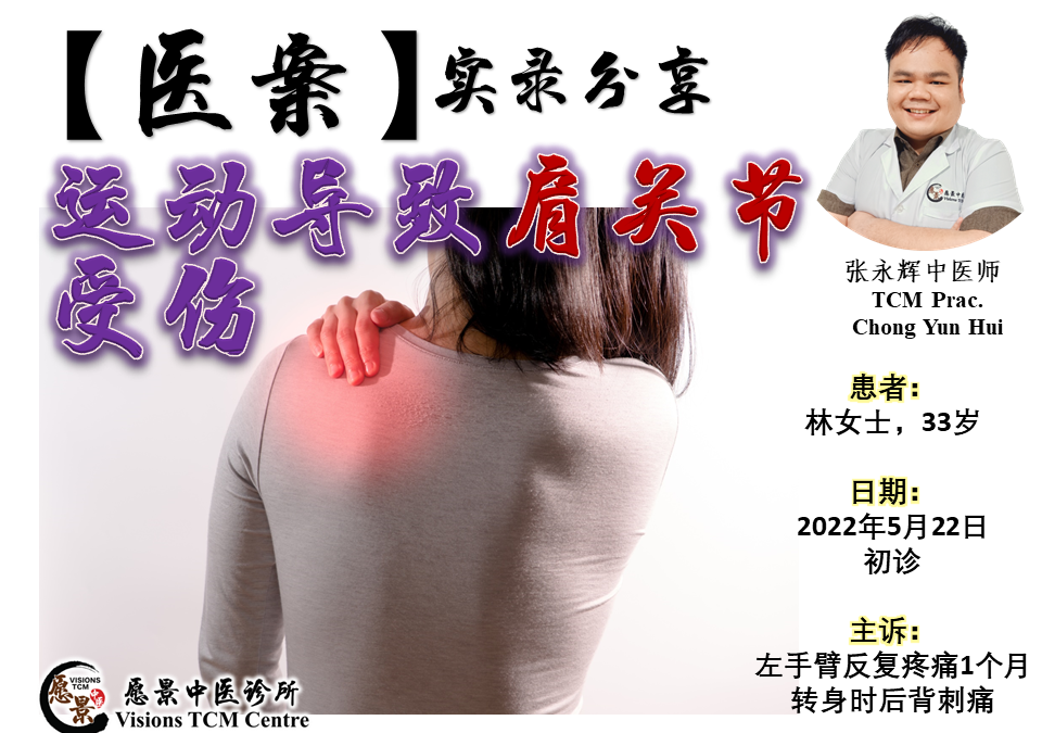 【医案实录】运动导致肩关节受伤 – 张永辉医师