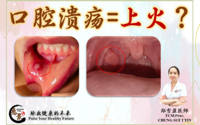 经常口腔溃疡，真的只是“上火”吗？郑雪盈医师