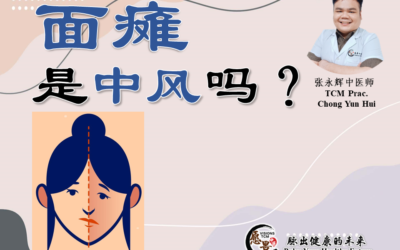 面瘫是中风吗？中医有哪些治疗方法？张永辉中医师