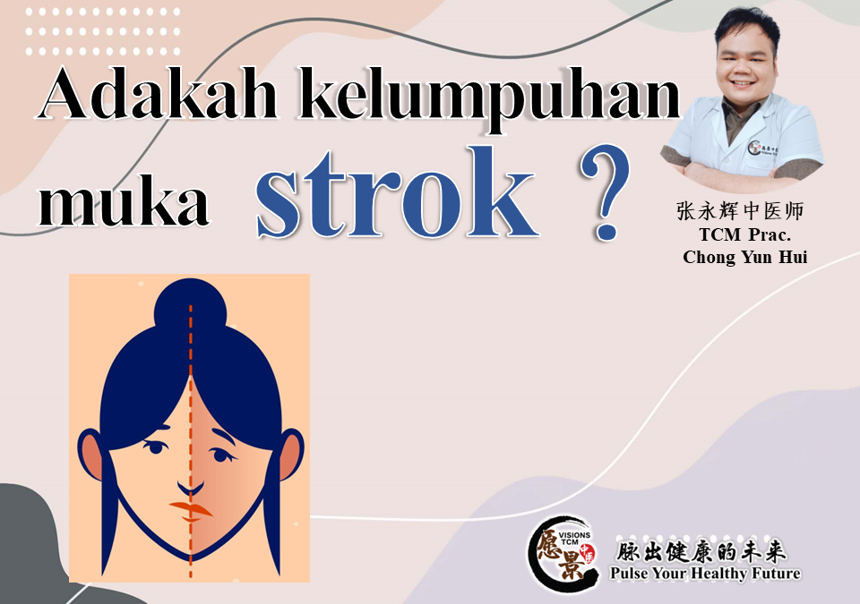 Adakah kelumpuh muka strok ?