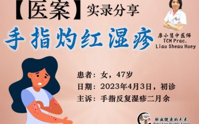 【医案分享】手指灼红湿疹 – 廖小慧医师