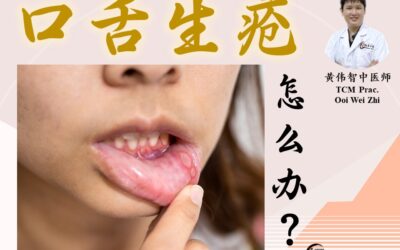 经常口舌生疮怎么办？黄伟智医师