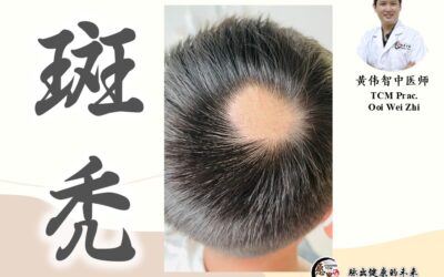 斑秃 – 黄伟智医师