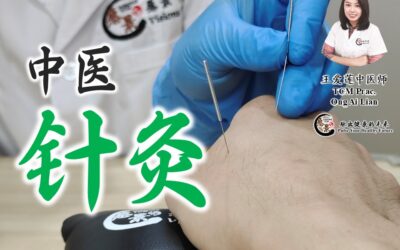 中医针灸 – 王爱莲医师