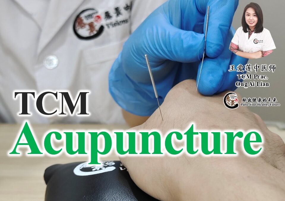Traditional Chinese Acupuncture