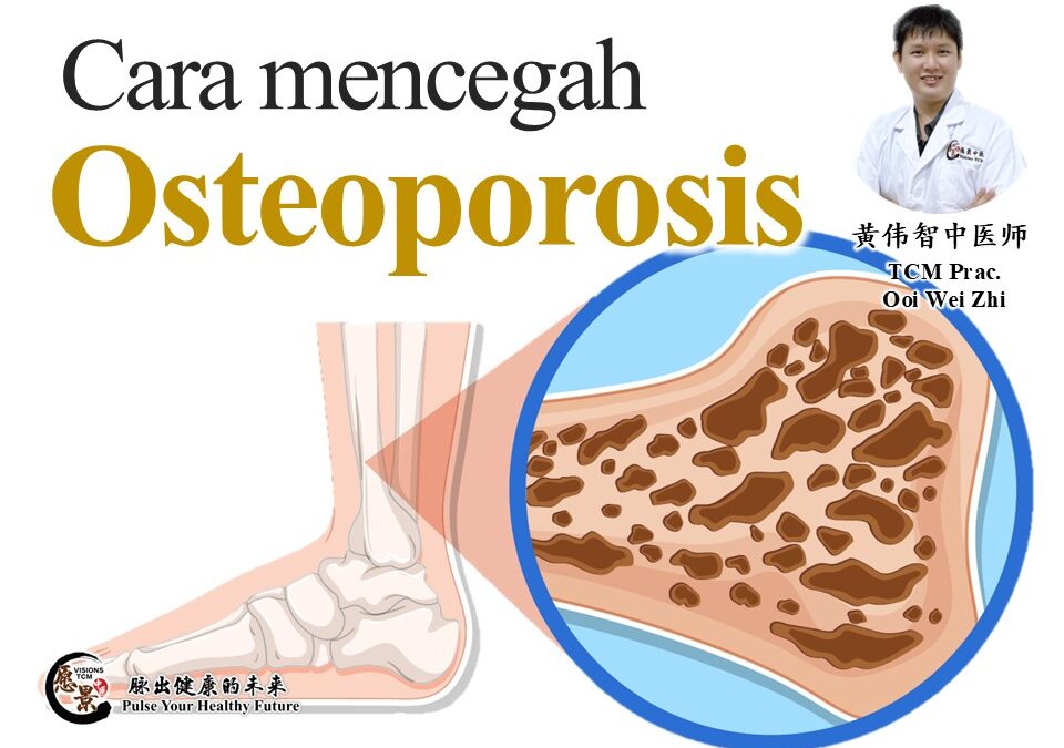 Bagaimana mencegah osteoporosis?