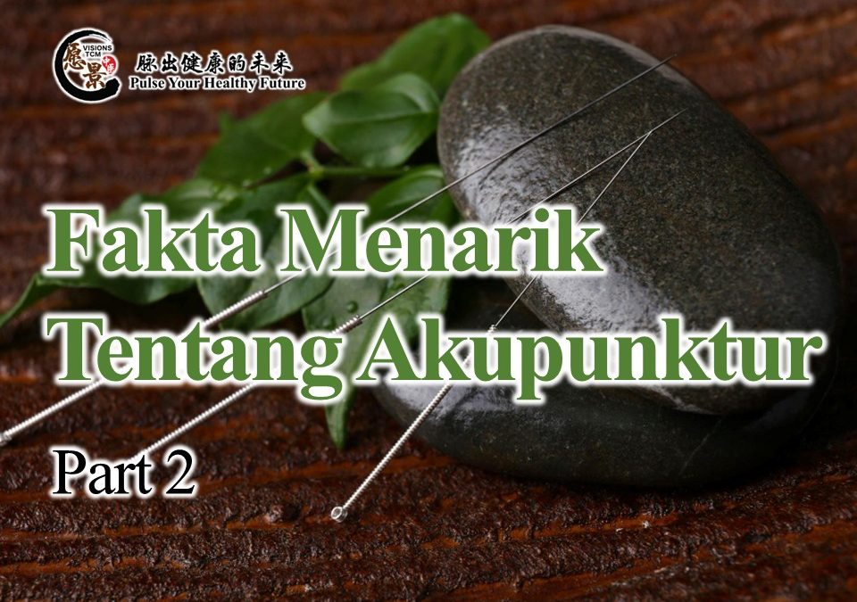 Fakta Menarik Tentang Akupunktur (Bahagian 2)