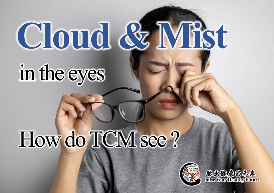 “Shifting Clouded Vision” — The Traditional Chinese Medicine View of Floaters