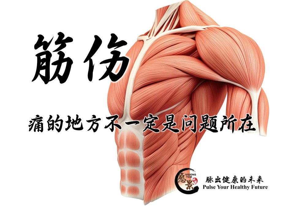 筋伤，痛的地方不一定就是问题所在