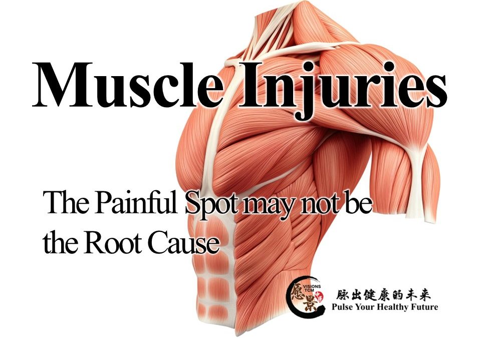 Muscle and Tendon Injuries: The Source of Pain May Not Be Where It Hurts